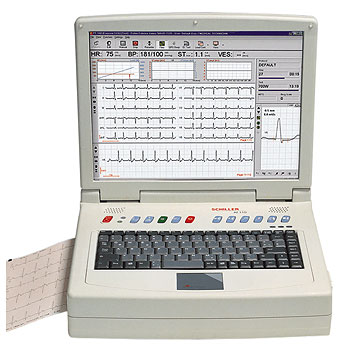 ЭКГ Schiller CardioLaptop AT-110 : Медтехника Самара ЭКГ Schiller CardioLaptop AT-110 : Медтехника Самара